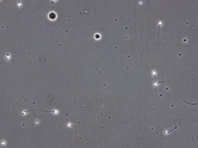 Sample image from VISEM-Tracking