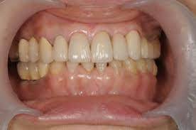 Sample image from Dentalai