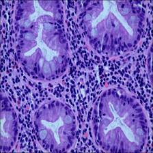 Sample image from EBHI-Seg