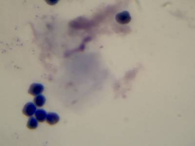 Sample image from Microscopy Malaria Dataset