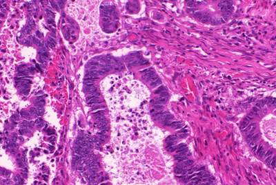 Sample image from GlaS@MICCAI'2015: Gland Segmentation