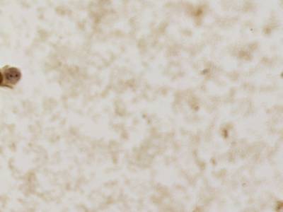 Sample image from CCAgT