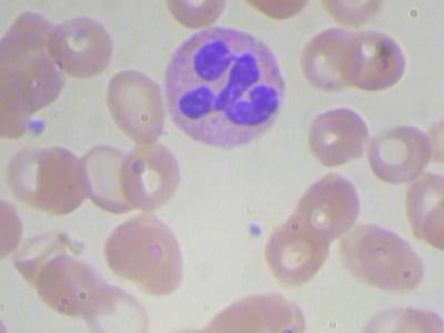 Sample image from BCCD