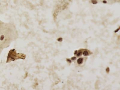 Sample image from CCAgT