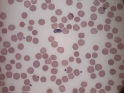 Sample image from MP IDB