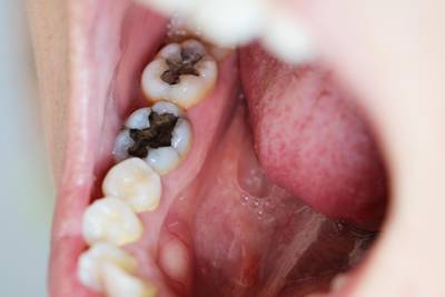 Sample image from Dentalai