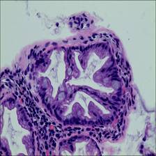 Sample image from EBHI-Seg