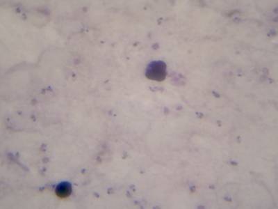 Sample image from Microscopy Malaria Dataset