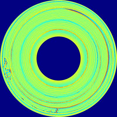 Sample image from BTAD