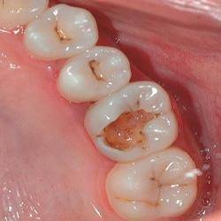 Sample image from Dentalai