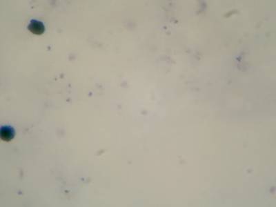 Sample image from Microscopy Malaria Dataset