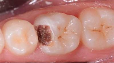 Sample image from Dentalai