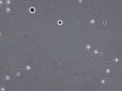 Sample image from VISEM-Tracking