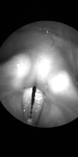 Sample image from BAGLS: Images