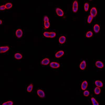 Sample image from DeepBacs E. Coli