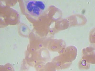 Sample image from BCCD