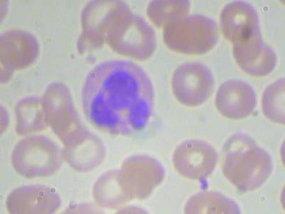 Sample image from BCCD