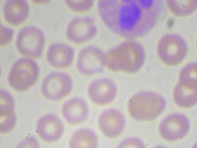 Sample image from BCCD