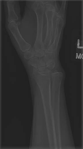Sample image from Bone Classification and Detection Dataset