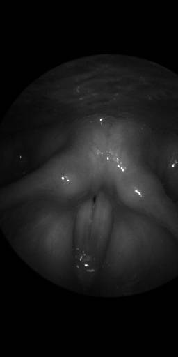 Sample image from BAGLS: Images