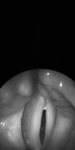 Sample image from BAGLS: Images