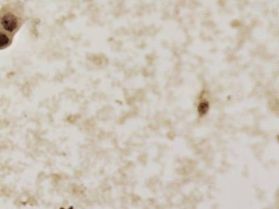 Sample image from CCAgT