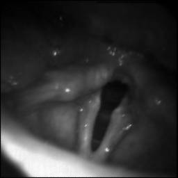 Sample image from BAGLS: Images