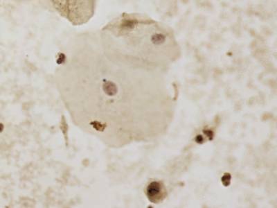 Sample image from CCAgT