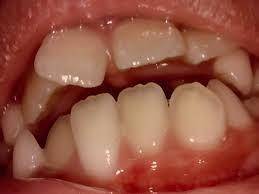 Sample image from Dentalai