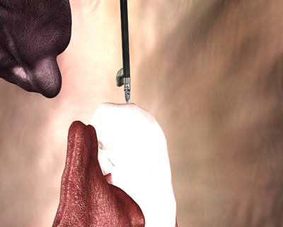 Sample image from SISVSE
