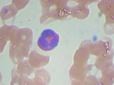 Sample image from BCCD