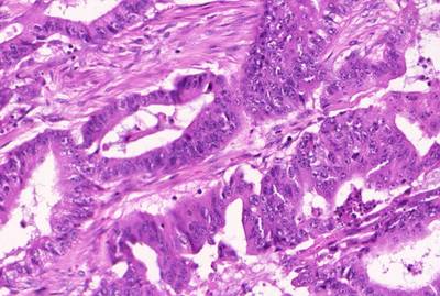 Sample image from GlaS@MICCAI'2015: Gland Segmentation