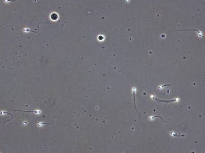 Sample image from VISEM-Tracking