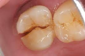 Sample image from Dentalai