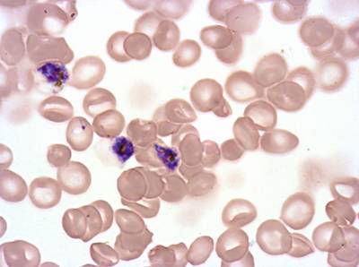 Sample image from Plasmodium Falciparum from Images of Giemsa for Malaria Detection