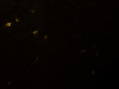 Sample image from Fluorescent Neuronal Cells