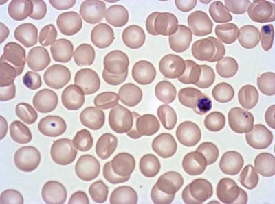 Sample image from Plasmodium Falciparum from Images of Giemsa for Malaria Detection