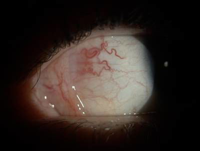 Sample image from Eyes Microcirculation