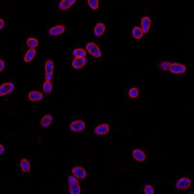 Sample image from DeepBacs E. Coli