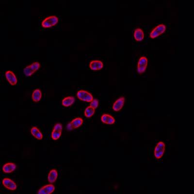 Sample image from DeepBacs E. Coli