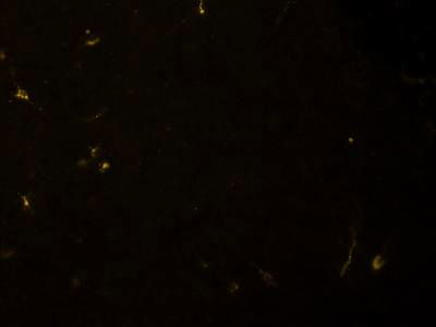 Sample image from Fluorescent Neuronal Cells