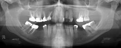 Sample image from Panoramic Dental X-rays