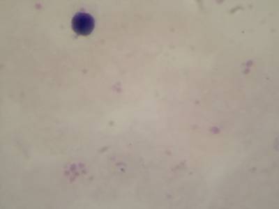 Sample image from Microscopy Malaria Dataset