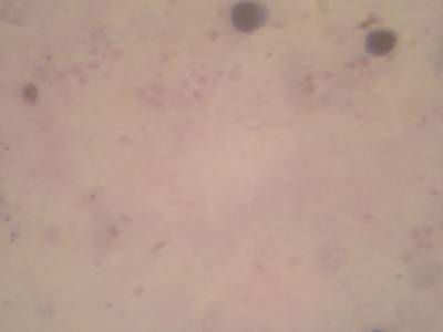 Sample image from Microscopy Malaria Dataset