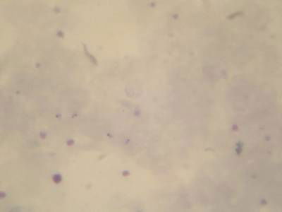 Sample image from Microscopy Malaria Dataset