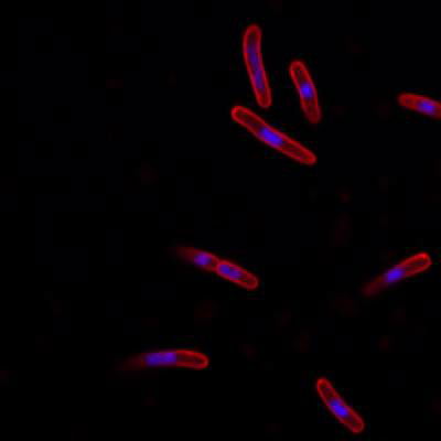 Sample image from DeepBacs E. Coli