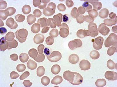 Sample image from Plasmodium Falciparum from Images of Giemsa for Malaria Detection