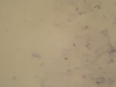 Sample image from Microscopy Malaria Dataset