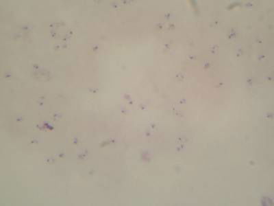 Sample image from Microscopy Malaria Dataset