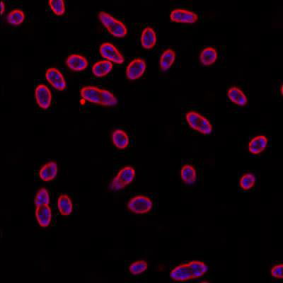 Sample image from DeepBacs E. Coli